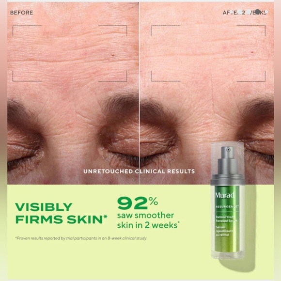 BNIB Murad Resurgence Overnight Renewal Set – Full-Size Serum & Jumbo Cleanser - Picture 8 of 16